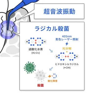 画像に alt 属性が指定されていません。ファイル名: blueradical_3-3.jpg